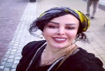 تغییر چهره باورنکردنی فلور نظری با عمل زیبایی جدید /خانم بازیگر شبیه سحرتبر شد +عکس شوکه کننده